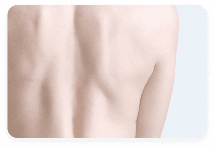 Recupero Tono Muscolare