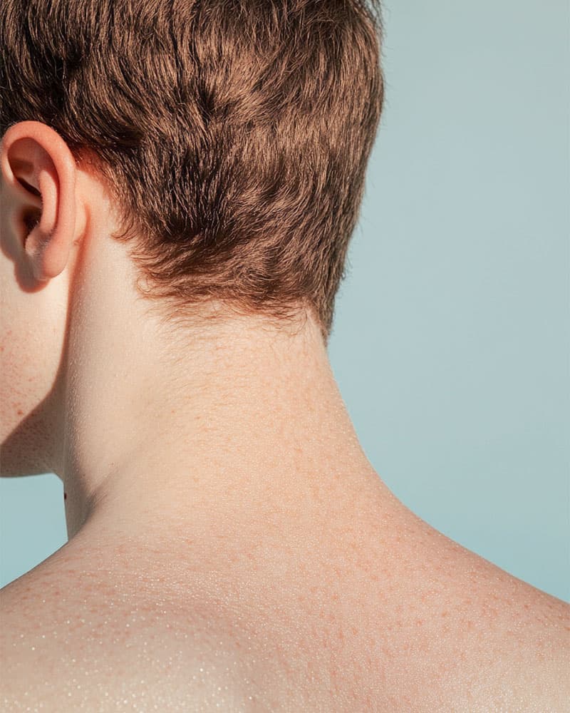 Trapianto di Capelli MicroGraft