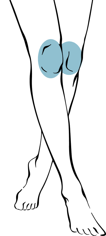 Ginocchia