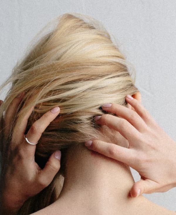 Alopecia
