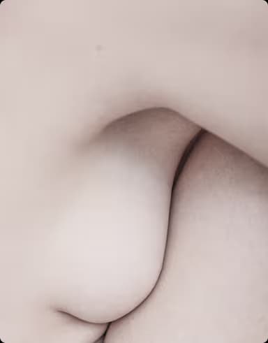 Chirurgia Rigenerativa del Seno