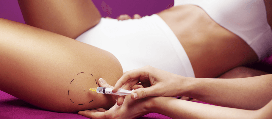 Cellulite? È tempo di scoprire le gambe
