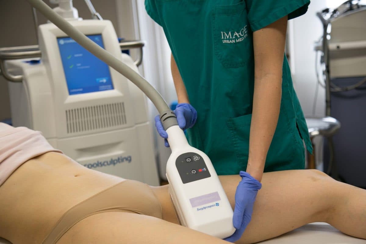 CoolSculpting: il freddo che ridisegna il tuo corpo