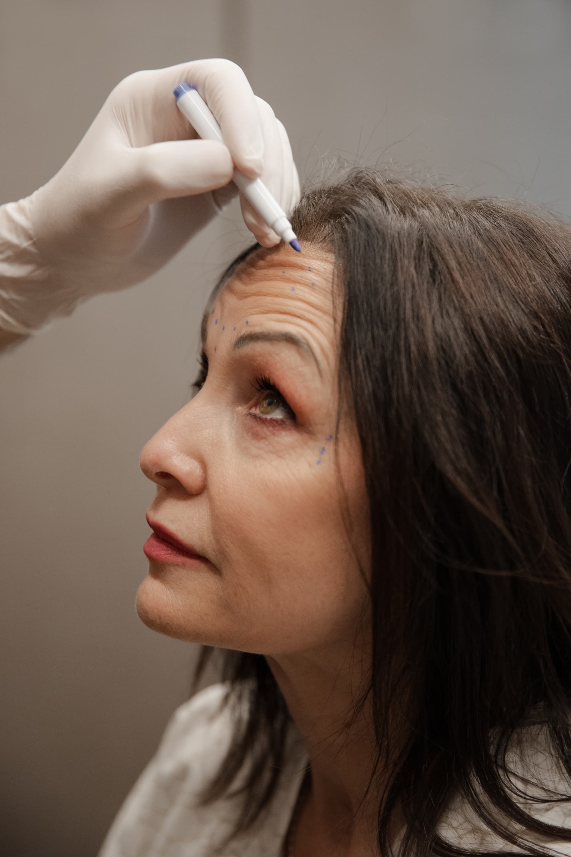 How Does Botox Work for Wrinkles? Efficacy and Timeline