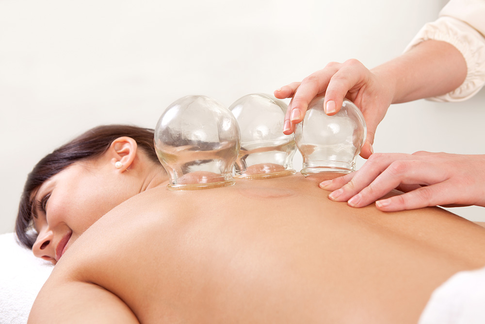 Cupping Therapy: Il Massaggio Olistico